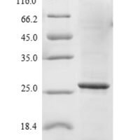Human Sodium-dependent phosphate transport protein 2B (SLC34A2), partial Recombinant Protein, N-His-B2M - BioCrest Sci