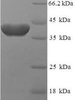 Human Ras-related protein Rab-2A (RAB2A) Recombinant Protein - BioCrest Sci