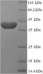 Human Ras-related protein Rab-2A (RAB2A) Recombinant Protein, Homo sapiens (Human), E.coli, N-terminal 6xHis-SUMO-tagged, 39.4 kDa, purity >≥ 90% as determined by SDS-PAGE.