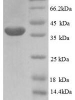 Human PHD finger-like domain-containing protein 5A (PHF5A) Recombinant Protein - BioCrest Sci