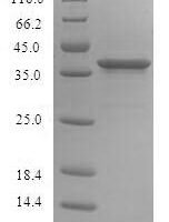 Human Signal-regulatory protein beta-1 (SIRPB1), partial Recombinant Protein, N-His, aa 30–371, Yeast - BioCrest Sci
