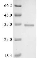 Sphingobium sp. Beta-etherase (ligE) Recombinant Protein, C-His, aa 2–281, Yeast - BioCrest Sci