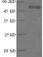 Human High mobility group protein B1 (HMGB1), partial Recombinant Protein - BioCrest Sci