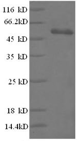 Human High mobility group protein B1 (HMGB1), partial Recombinant Protein, Homo sapiens (Human), E.coli, N-terminal GST-tagged, 46.7 kDa, purity >≥ 90% as determined by SDS-PAGE.