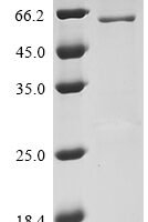 Human Transmembrane protease serine 2 (TMPRSS2), partial Recombinant Protein - BioCrest Sci