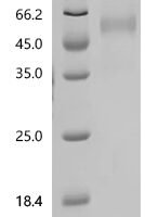 Cat Zona pellucida sperm-binding protein 3 (ZP3) Recombinant Protein, C-10His - BioCrest Sci
