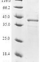 Human Nuclear transport factor 2 (NUTF2) Recombinant Protein - BioCrest Sci