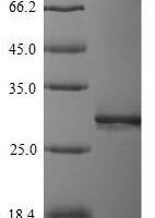 Human Leukocyte immunoglobulin-like receptor subfamily A member 5 (LILRA5), partial Recombinant Protein, N-His-Myc - BioCrest Sci