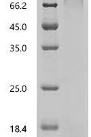 Mouse Neutrophil elastase (Elane) Recombinant Protein, N-His - BioCrest Sci