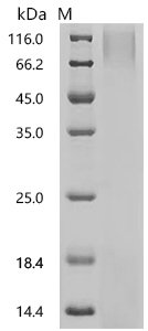 Mouse Neutrophil elastase (Elane) Recombinant Protein, N-His, Mus musculus (Mouse), Yeast, N-terminal 6xHis-tagged, 27.6 kDa, purity >≥ 95% as determined by SDS-PAGE.