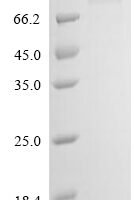 Gossypium hirsutum Cellulose synthase (LOC107958683) (S143G) Recombinant Protein - BioCrest Sci