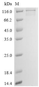 Gossypium hirsutum Cellulose synthase (LOC107958683) (S143G) Recombinant Protein, Gossypium hirsutum (Upland cotton) (Gossypium mexicanum), in vitro E.coli expression system, C-terminal 6xHis-tagged, 119.8 kDa, purity >≥ 85% as determined by SDS-PAGE.