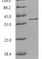 Chlorocebus aethiops Cathepsin L1 (CTSL1), partial Recombinant Protein - BioCrest Sci