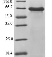 Human 2-5A-dependent ribonuclease (RNASEL), partial Recombinant Protein, N-His-SUMO - BioCrest Sci