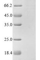 Pseudomonas putida Arylalkyl acylamidase Recombinant Protein - BioCrest Sci