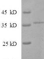 Sulfolobus islandicus Chromatin protein Cren7 (creN7) Recombinant Protein - BioCrest Sci
