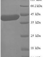 Human Alpha N-terminal protein methyltransferase 1A (METTL11A) Recombinant Protein - BioCrest Sci