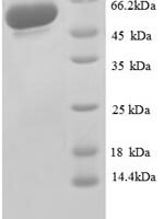 Human Glyceraldehyde-3-phosphate dehydrogenase (GAPDH), partial Recombinant Protein - BioCrest Sci