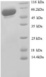 Human Glyceraldehyde-3-phosphate dehydrogenase (GAPDH), partial Recombinant Protein, Homo sapiens (Human), E.coli, N-terminal GST-tagged, 62.9 kDa, purity >≥ 90% as determined by SDS-PAGE.