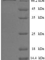 Human E3 ubiquitin-protein ligase parkin (PRKN) Recombinant Protein - BioCrest Sci