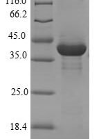 Human Protein chibby homolog 1 (CBY1) Recombinant Protein - BioCrest Sci
