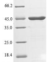 Human Endophilin-A2 (SH3GL1) Recombinant Protein - BioCrest Sci
