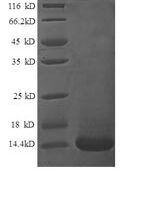 Human Lymphotactin protein (XCL1) Recombinant Protein - BioCrest Sci