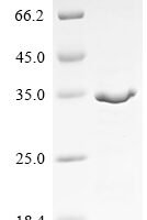 Drosophila melanogaster Maternal effect protein staufen (stau), partial Recombinant Protein - BioCrest Sci