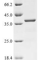 Human Alpha-tocopherol transfer protein (TTPA) Recombinant Protein, C-His - BioCrest Sci