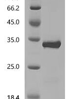 Staphylococcus aureus Immunodominant staphylococcal antigen B (isaB) Recombinant Protein, N-His-SUMOstar - BioCrest Sci