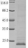Macaca fascicularis Apolipoprotein C-III (APOC3) Recombinant Protein, N-His-SUMOstar - BioCrest Sci
