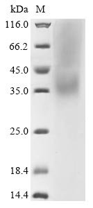 Human coronavirus HKU1 Spike glycoprotein (S), partial Recombinant Protein, C-His, aa 310–622, UniProt Q0ZME7, Human coronavirus HKU1 (isolate N5) (HCoV-HKU1), Yeast, C-terminal 6xHis-tagged, 36.3 kDa, purity >≥ 90% as determined by SDS-PAGE.