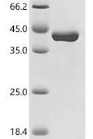Listeria monocytogenes serovar 1/2a Internalin B (inlB), partial Recombinant Protein - BioCrest Sci