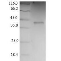 Human Cyclin-dependent kinase 2 (CDK2) Recombinant Protein - BioCrest Sci