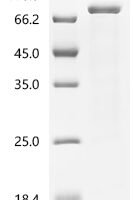 Human Transcriptional coactivator YAP1 (YAP1) Recombinant Protein, C-10His - BioCrest Sci