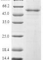 Human Pre-mRNA-splicing factor SPF27 (BCAS2) Recombinant Protein - BioCrest Sci