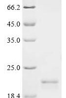 Human Sorting nexin-12 (SNX12) Recombinant Protein, C-His - BioCrest Sci