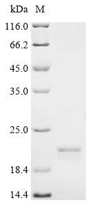 Human Sorting nexin-12 (SNX12) Recombinant Protein, C-His, Homo sapiens (Human), Yeast, C-terminal 6xHis-tagged, 20.6 kDa, purity >≥ 95% as determined by SDS-PAGE.