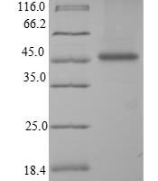 Human Paralemmin-1 (PALM) Recombinant Protein - BioCrest Sci