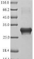 Parietaria judaica Probable non-specific lipid-transfer protein 2 (LTP2) Recombinant Protein - BioCrest Sci