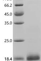 Human Coagulation factor IX (F9), partial Recombinant Protein, C-10His, aa 93–129, E.coli - BioCrest Sci
