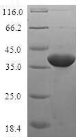 Human TGFB1-induced anti-apoptotic factor 1 (TIAF1) Recombinant Protein - BioCrest Sci