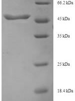 Human Transforming growth factor beta-3 proprotein (TGFB3), partial Recombinant Protein, N-His-SUMO - BioCrest Sci