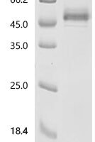 Human Lymphocyte antigen 6K (LY6K) Recombinant Protein, C-mFc2a - BioCrest Sci