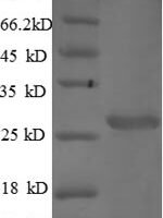 Mouse Cathepsin S (Ctss) Recombinant Protein - BioCrest Sci