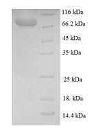 Human Breast carcinoma-amplified sequence 1 (BCAS1) Recombinant Protein, N-GST - BioCrest Sci