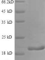 Human Interferon gamma (IFNG) Recombinant Protein, N-His, aa 24–161, E.coli - BioCrest Sci