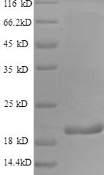 Human Interferon gamma (IFNG) Recombinant Protein, N-His, aa 24–161, E.coli, Homo sapiens (Human), E.coli, N-terminal 6xHis-tagged, 20.2 kDa, purity >≥ 90% as determined by SDS-PAGE.
