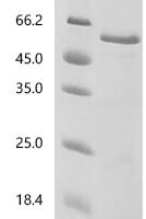 Human Cholesteryl ester transfer protein (CETP) Recombinant Protein, N-10His/C-Myc - BioCrest Sci
