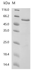 Human Cholesteryl ester transfer protein (CETP) Recombinant Protein, N-10His/C-Myc, Homo sapiens (Human), E.coli, N-terminal 10xHis-tagged and C-terminal Myc-tagged, 58.1 kDa, purity >≥ 85% as determined by SDS-PAGE.